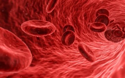 What is Inflammation and How Do I Treat It?