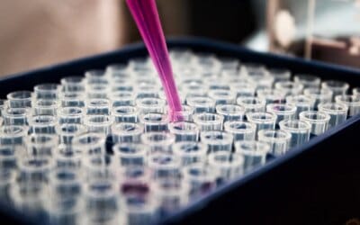 What Are the Advantages of Advanced Lipid Testing?