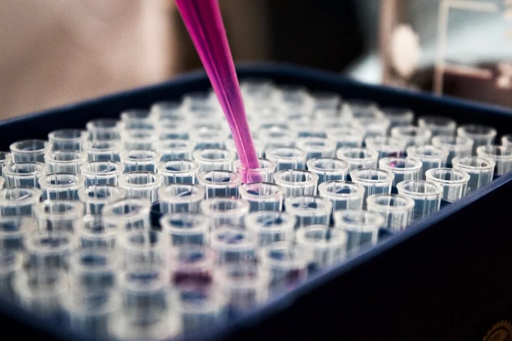 What Are the Advantages of Advanced Lipid Testing?